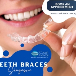 Teeth Braces Singapore