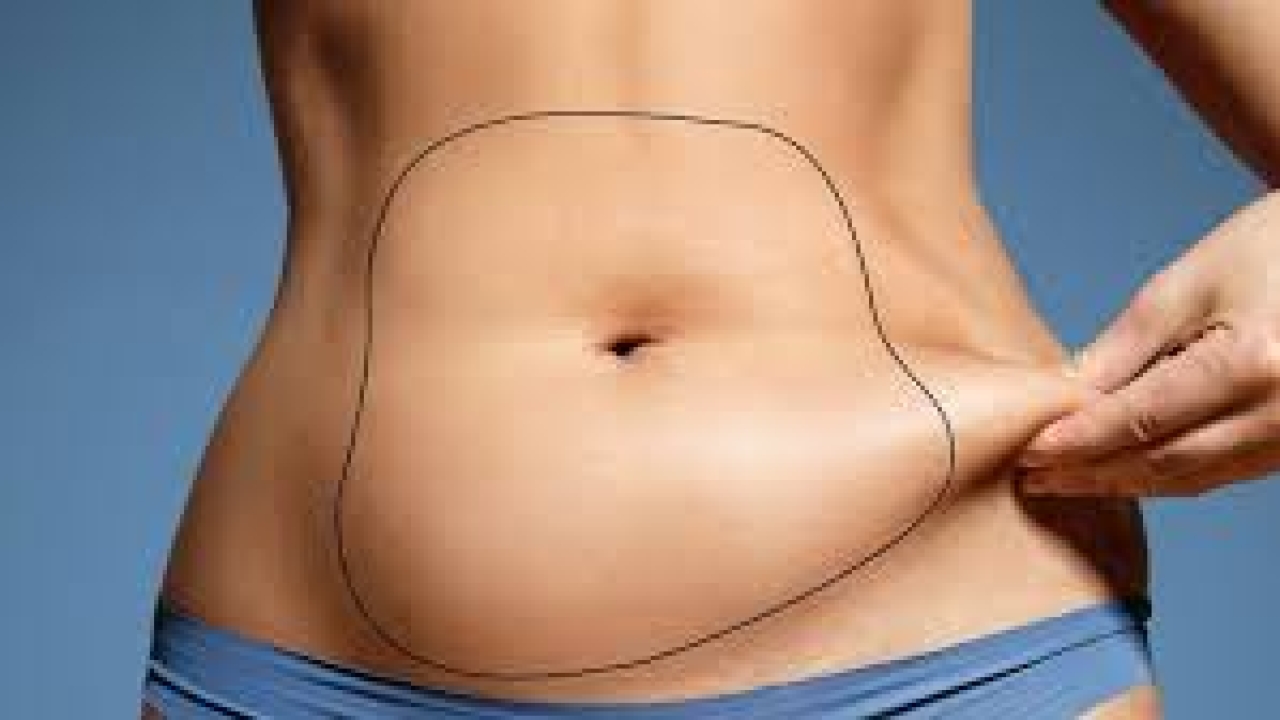  Liposuction Transformations: Before and After