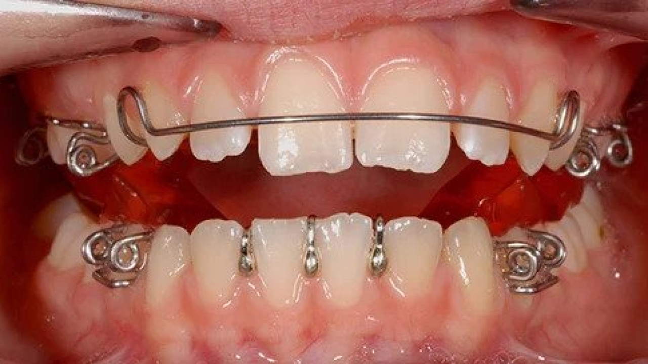 Orthodontic Technology Advancements in Dentofacial Orthopedics ChatGPT