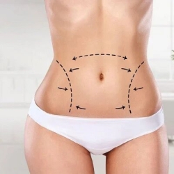 Liposuction for Post-Pregnancy Body Transformation