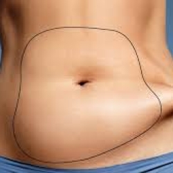  Liposuction Transformations: Before and After