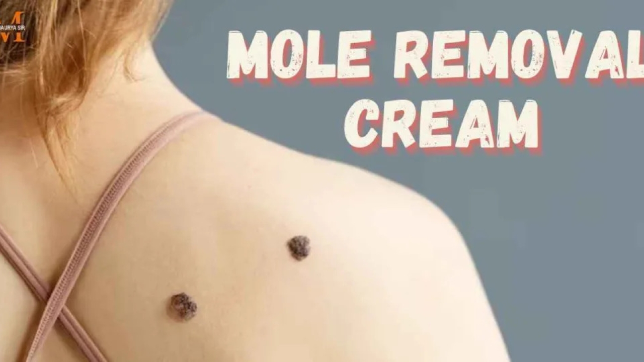 How to Choose the Best Mole Removal Cream